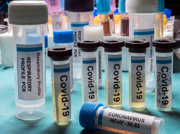 istock Vials containing samples from patients infected with covid19 coronavirus in a laboratory, Spain 1216833991