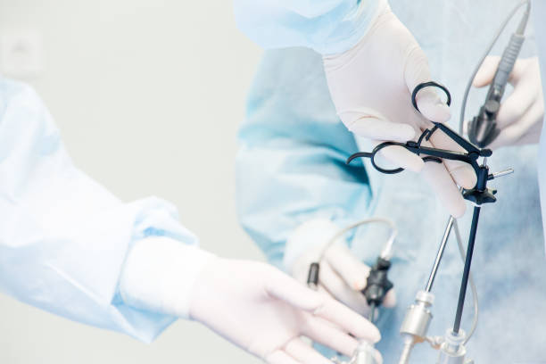 Surgeon performs laparoscopic surgery on the abdomen. Close-up of a laparoscope and doctor's hands stock photo