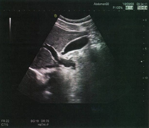 istock Abdomen Ultrasound Medical Examination Image 1216911249