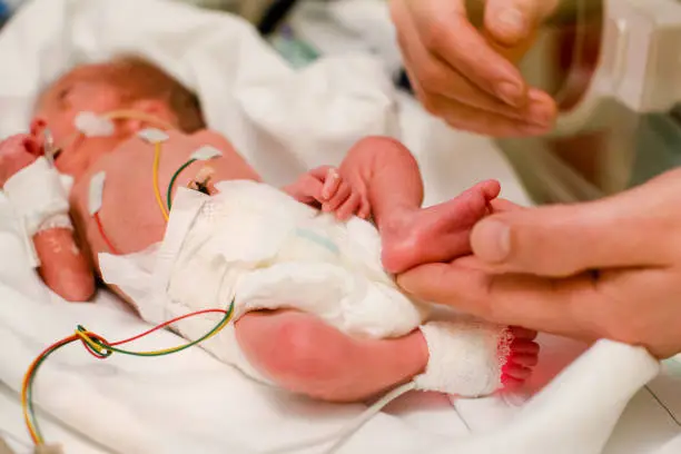 wired premature baby lies in the incubator and the dad caresses the little foot