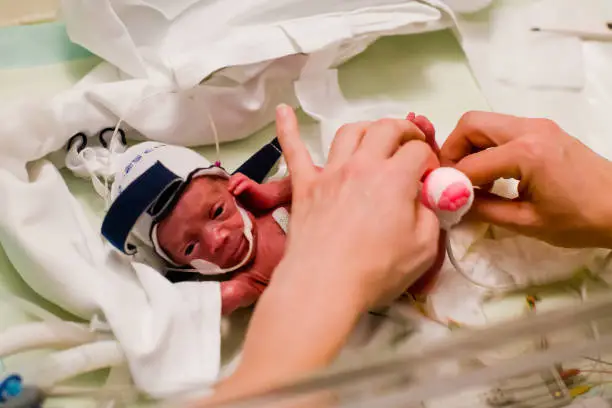 premature baby (650g) is in the incubator and mom changes the diaper