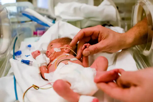 wired premature baby lies in the incubator and the dad caresses the little hand