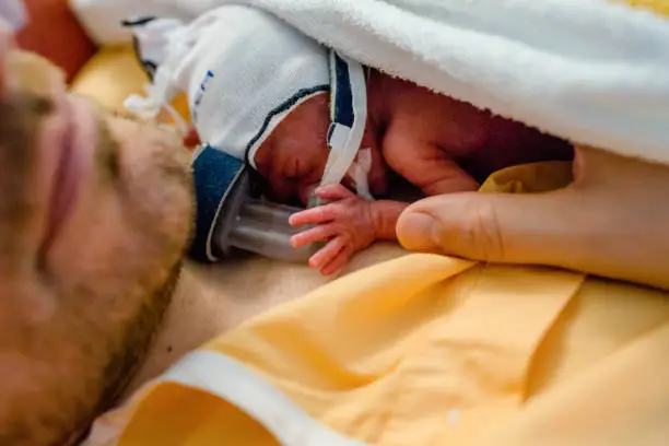 Premature baby born in the 28th week of pregnancy lies on Papa's chest