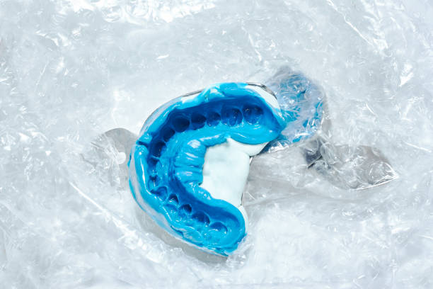 Two dental molds in a box for transportation