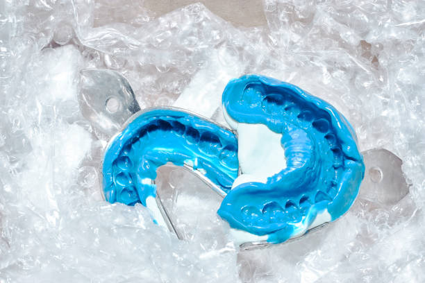 istock Two dental molds in a box for transportation 1216937571