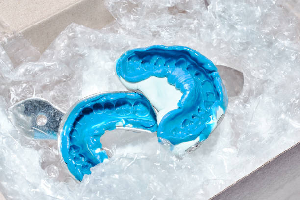 istock Two dental molds in a box for transportation 1216937576