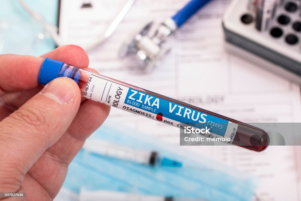 Blood samples with infected virus Fictional Blood samples with infected Zika virus, with stethoscope, mask and syringe and other stuff. Zika Virus Stock Photo