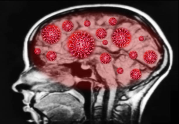 illustrazione di rendering 3d il polmone dei raggi x del coronavirus mostra danni terrificanti nei polmoni del covid-19 analizza il primo paziente statunitense con illustrazione del coronavirus, mostra danni terrificanti nei polmoni.illustrazione - pill purple capsule vitamin pill foto e immagini stock