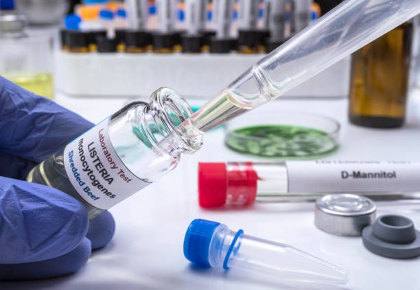 istock Expert analyzes stuffed meat contaminated by bacterium of listeria in laboratory, sprout caused in Spain 1217128470