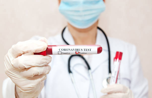 istock Nurse holding test tube with blood for 2019-nCoV analyzing 1217163668