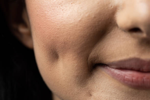 Cheek dimple Macro closeup of Caucasian woman smiling having dimples. Beauty concept. cheek stock pictures, royalty-free photos & images