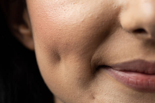 Cheek dimple Macro closeup of Caucasian woman smiling having dimples. Beauty concept. skin cheek stock pictures, royalty-free photos & images