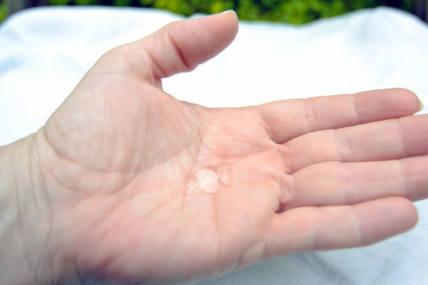 istock alcohol gel in caucasian hand 1217215009
