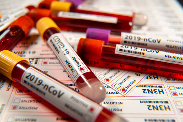istock Covid-19 infectious disease, coronavirus a global threatsars-cov 2 pasitive blood test 1217248723