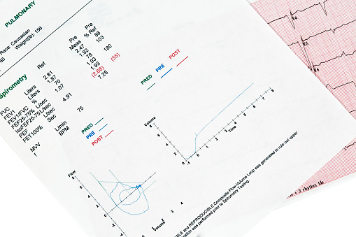 Close Up of pulmonary report showing spirometry graph with an ECG graph behind it