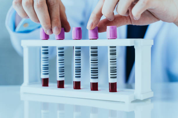 manos de un técnico de laboratorio con tubos de muestra de análisis de sangre en una fila para análisis de sangre de laboratorio - medical sample fotografías e imágenes de stock