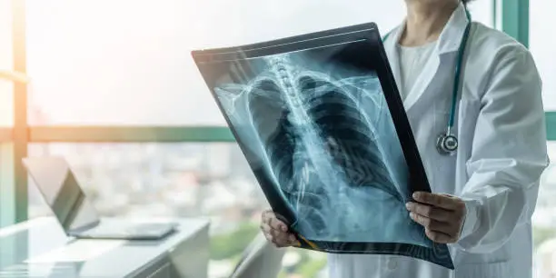 Doctor diagnosing patientâs health on asthma, lung disease, COVID-19 or bone cancer illness with radiological chest x-ray film for medical healthcare hospital service