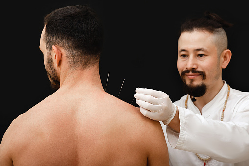 Reflexologist hand with acupuncture needle near the shoulder man. Treatment of a manâs body with Chinese medicine methods. Needles on a black background close-up
