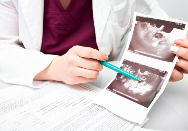 Folliculometry results. performing of ultrasound examinations, growth of follicles in the ovary Folliculometry results. performing of ultrasound examinations, growth of follicles in the ovary Ovulation stock pictures, royalty-free photos & images