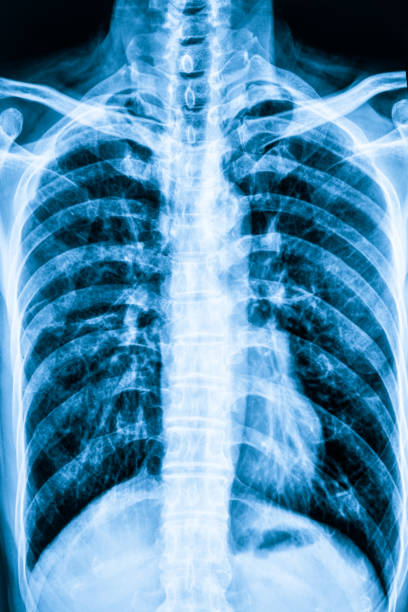 istock Perspective view of human chest 1217574972
