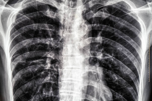 Wireframe image of the upper body part of a human body. An image that is not unpleasant. Reminiscent of medicine or disease.\n\nThis image was not created by AI.