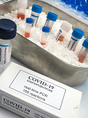 neuartigecoronavirus-2019-ncov-pcr-diagnose-kit-dies-ist-rt-pcr-kit-um-das-vorhandensein-von.jpg?b=1&s=170x170&k=20&c=wnspnWHpplx6YjxykIIdewkQVsb15Mu5dfc1Qi4Tyis=