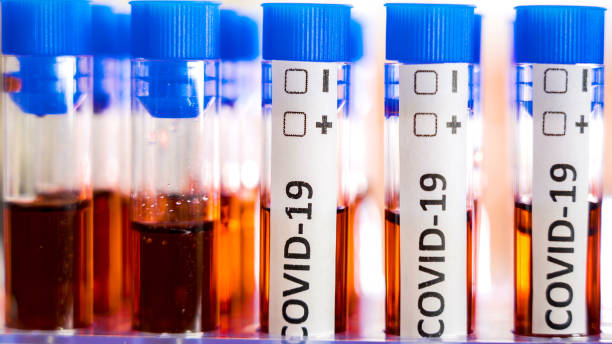 istock A microscope on the side of the test samples of the Covid-19 or coronavirus 1217661507