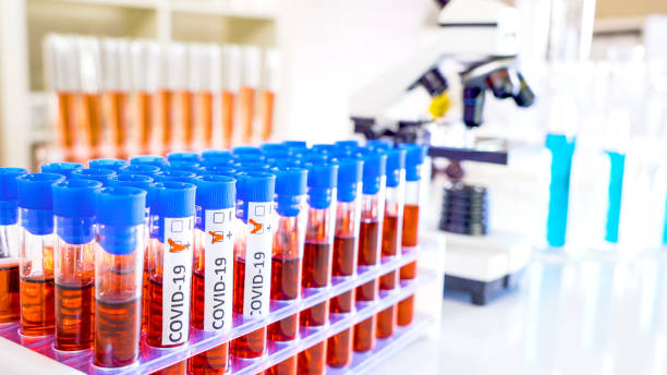 istock The equipments inside the laboratory with the coronavirus test samples 1217661623