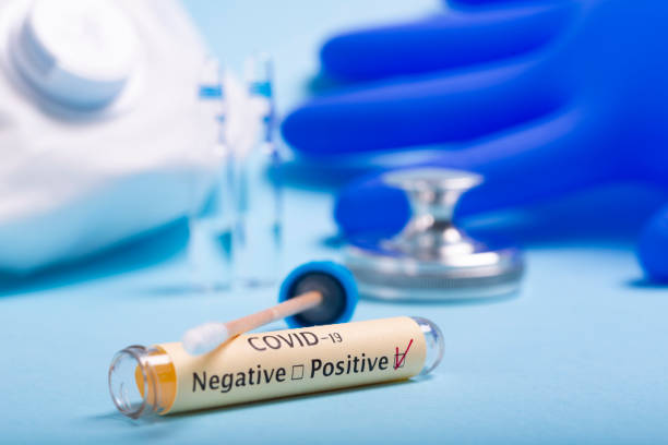 coronavirus covid-19 test wymazu do nosa. - microbiology analyzing laboratory scrutiny zdjęcia i obrazy z banku zdjęć