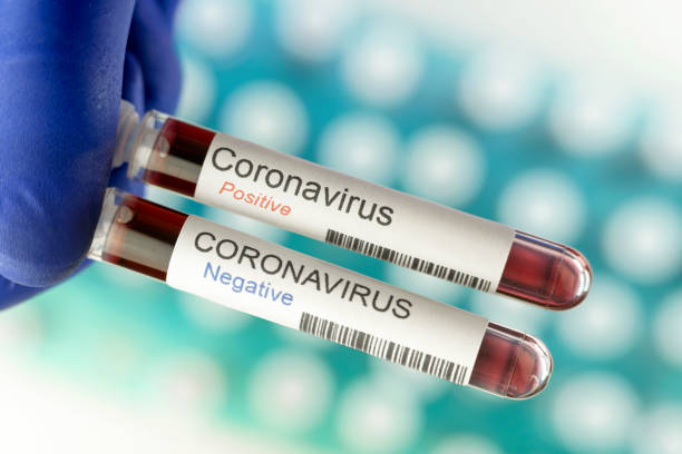 istock One negative and one positive result of coronavirus tests. 1217765916