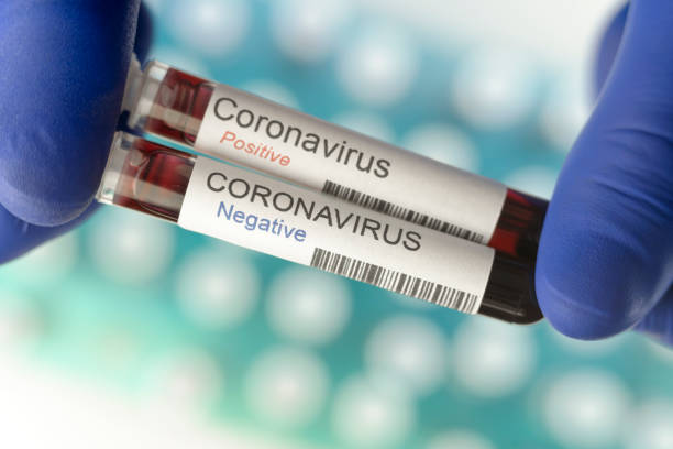 istock One negative and one positive result of coronavirus tests. 1217765917