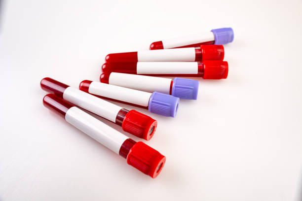 istock Blood tube with sample blood 1217782540