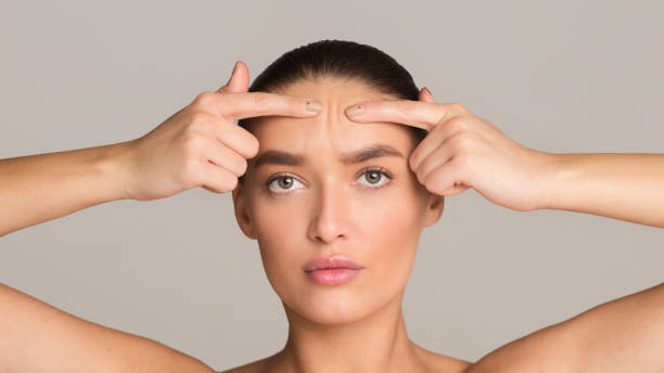istock Woman with problem skin looking at camera 1217792506