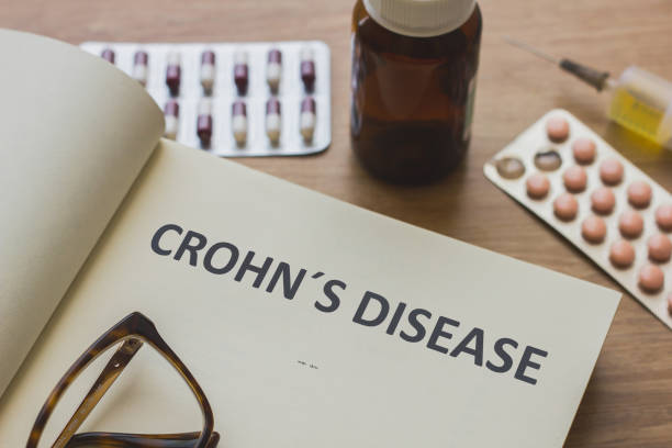 Book about Crohn´s Disease and medication, injection, syringe and pills. Medic concept Book about Crohn´s Disease and medication, injection, syringe and pills. Medic concept crohns disease stock pictures, royalty-free photos & images