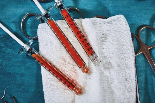 Greasy syringes for transplanting fat against a background of blue sterile tissue on a swab. Plastic surgery Greasy syringes for transplanting fat against a background of blue sterile tissue on a swab. Plastic surgery fat ugly face stock pictures, royalty-free photos & images