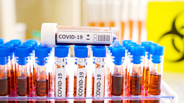 istock A yellow biological hazard sign on the table with the coronavirus test samples 2 1217978867