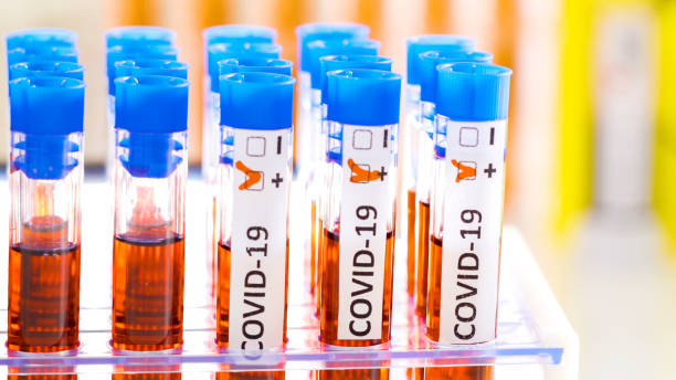 istock The coronavirus positive sample on the table biological hazard sign 1217978913