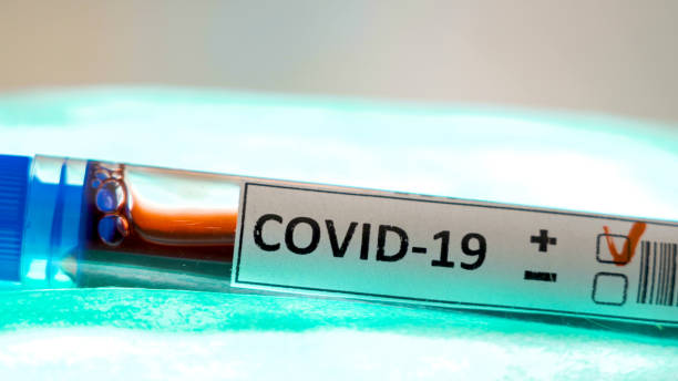 istock A blood sample inside the test tube with positive mark for coronavirus 1217979203