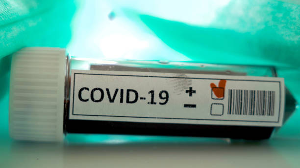 istock The small test kit with positive mark for coronavirus 1217979251