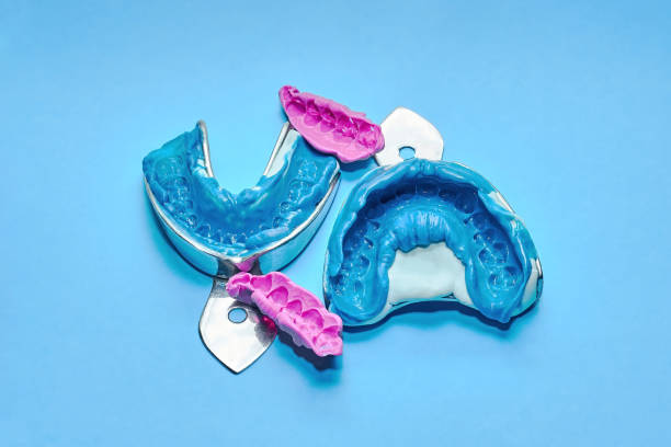 zwei zahnärztliche eindrücke mit bissregistrierung. - dental hygiene laboratory dental equipment technician stock-fotos und bilder