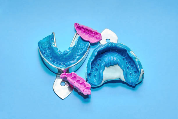 istock Two dental impressions with pieces of bite registration. 1217982829