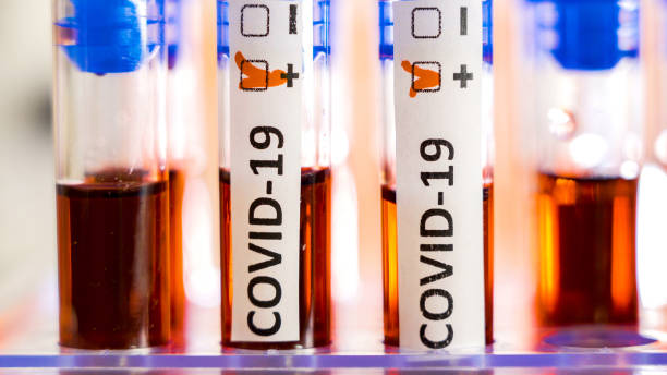 istock Three or COVID-19 coronavirus positive test on the tubes 1217984100
