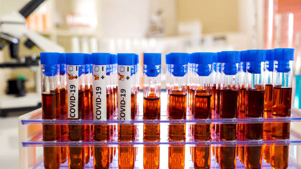 istock A view inside the laboratory with sample kits for COVID-19 coronavirus 1217984179