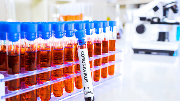 istock The test tube rack filled with samples for COVID-19 coronavirus 1217984583