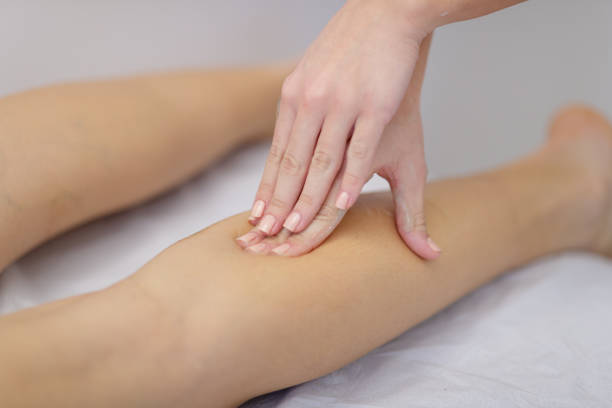 istock Massaging patient's calves by hand 1218007476