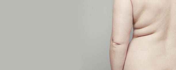 concepto de obesidad. cuerpo gordo femenino sobre un fondo gris con espacio de copia. el problema global del sobrepeso en el mundo. insulina elevada, cuerpo gordo - gordo complexión fotografías e imágenes de stock