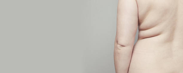 fetma koncept. kvinnlig fett kropp på en grå bakgrund med copyspace. det globala problemet med övervikt i världen. förhöjt insulin, fettkropp - kvinna stor rumpa bildbanksfoton och bilder