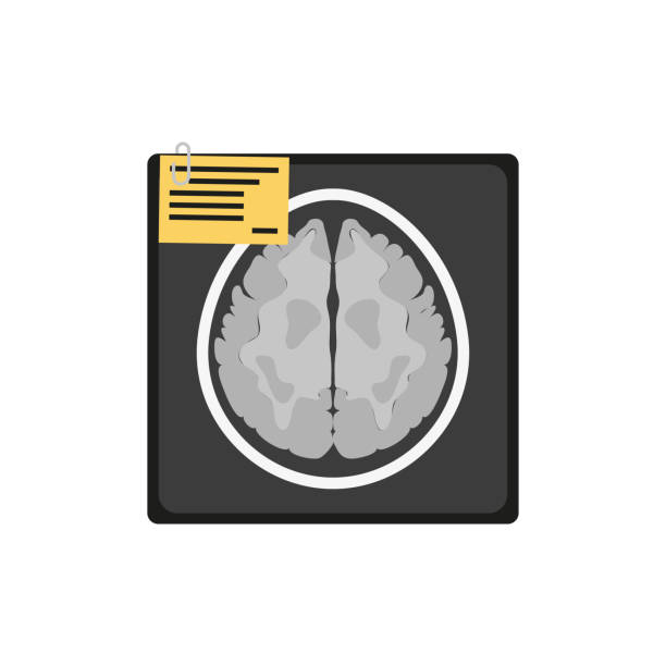 mri mózgu. płaska ikona z czarnym mózgiem do projektowania medycznego. - brain physical injury x ray image x ray stock illustrations