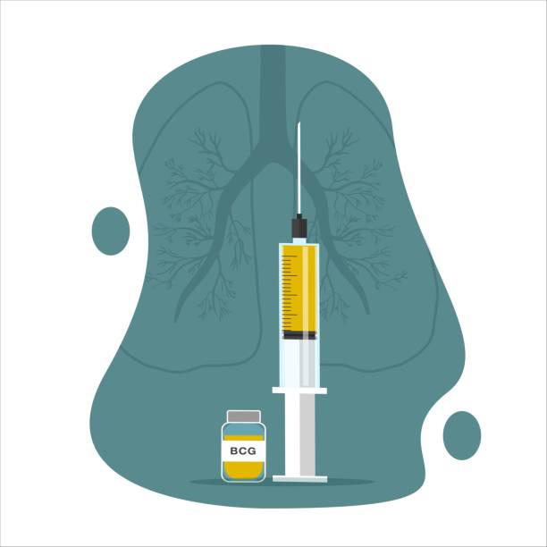 Ilustración de Bcg y más Vectores Libres de Derechos de Asistencia  sanitaria y medicina - Asistencia sanitaria y medicina, Bacteria de la  tuberculosis, Botella - iStock