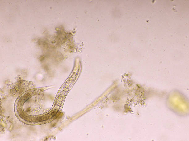 istock Strongyloides stercoralis in human stool 1218588100